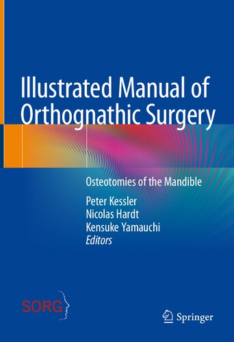 Illustrated Manual of Orthognathic Surgery: Osteotomies of the Mandible