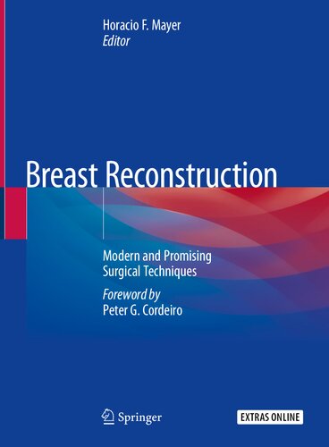 Breast Reconstruction: Modern and Promising Surgical Techniques