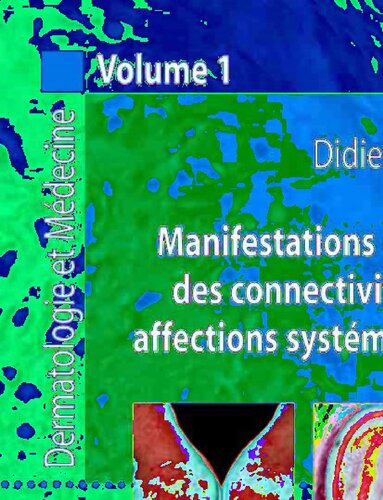 Manifestations dermatologiques des connectivites, vasculites et affections systémiques apparentées: Dermatologie et médecine