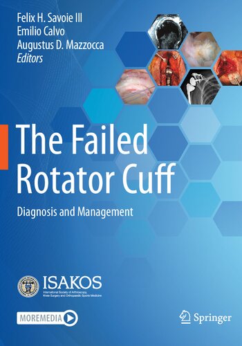 The Failed Rotator Cuff: Diagnosis and Management