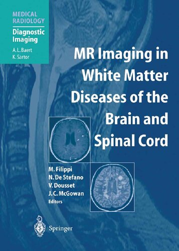 MR Imaging in White Matter Diseases of the Brain and Spinal Cord