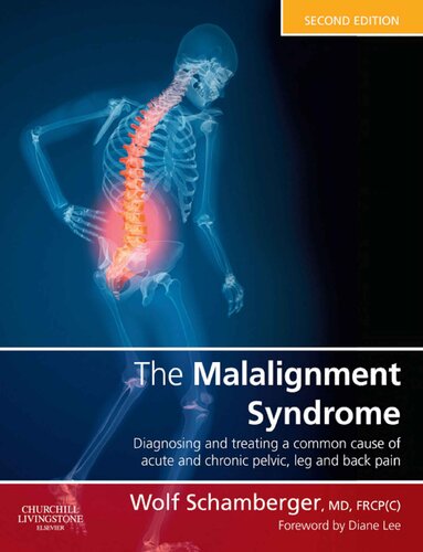 The malalignmemt syndrome