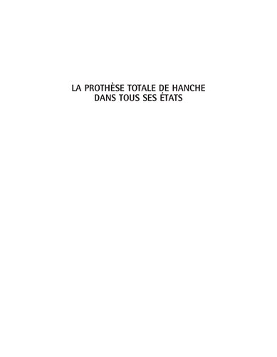 La Prothèse Totale de Hanche dans Tous ses états