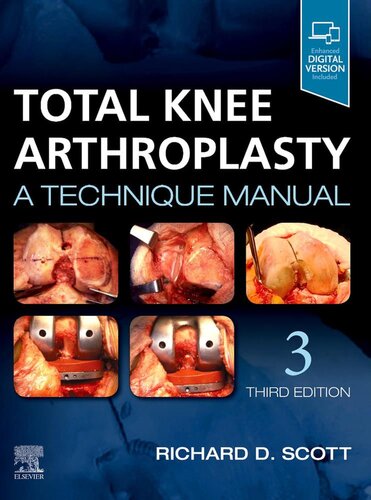 Total Knee Arthroplasty: A Technique Manual