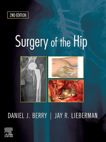 Surgery of the Hip