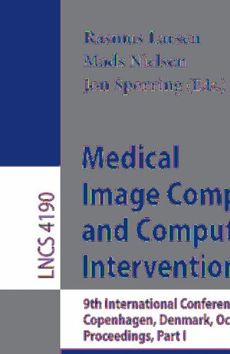 Medical Image Computing and Computer-Assisted Intervention – MICCAI 2006: 9th International Conference, Copenhagen, Denmark, October 1-6, 2006, Proceedings