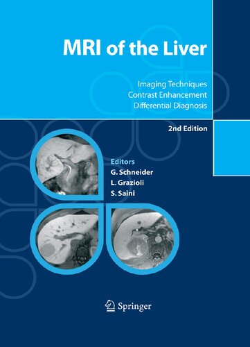 MRI of the Liver: Imaging Techniques Contrast Enhancement Differential Diagnosis