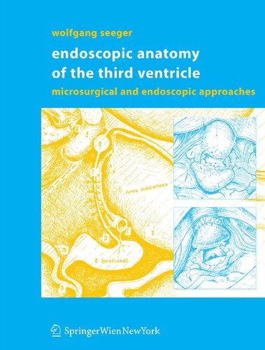 Endoscopic Anatomy of the Third Ventricle: Microsurgical and Endoscopic Approaches