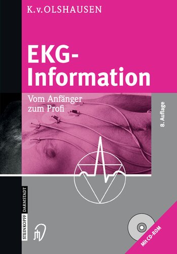 EKG-Information: Vom Anfänger zum Profi (German Edition)