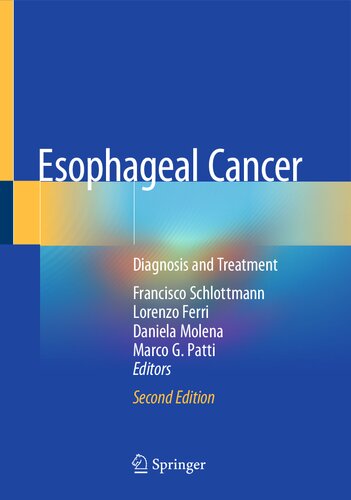 Esophageal Cancer: Diagnosis and Treatment