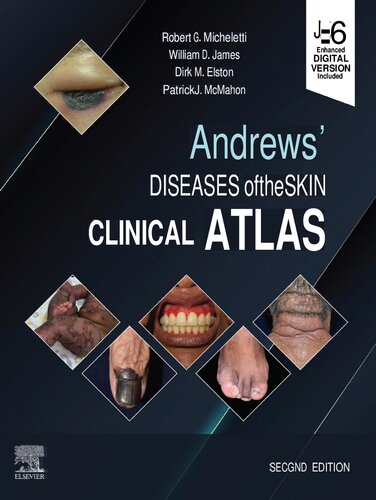 Andrews' Diseases of the Skin Clinical Atlas, 2e (April 6, 2022)_(0323790135)_(Elsevier).pdf