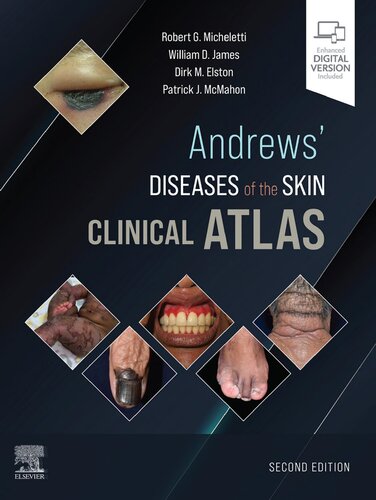Andrews' Diseases of the Skin Clinical Atlas