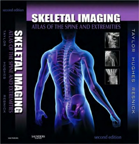 Skeletal Imaging: Atlas of the Spine and Extremities, Second Edition