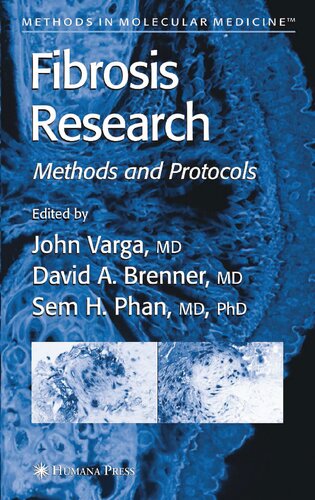 Fibrosis Research: Methods and Protocols
