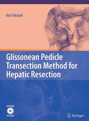 Glissonean Pedicle Transection Method for Hepatic Resection