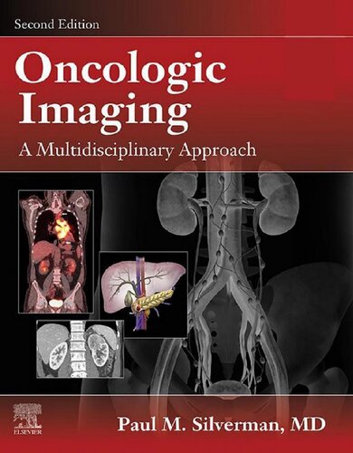 Oncologic Imaging: A Multidisciplinary Approach: Expert Consult - Online and Print