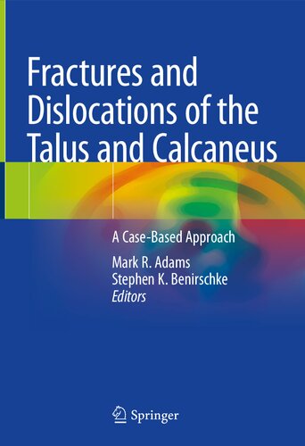 Fractures and Dislocations of the Talus and Calcaneus: A Case-Based Approach