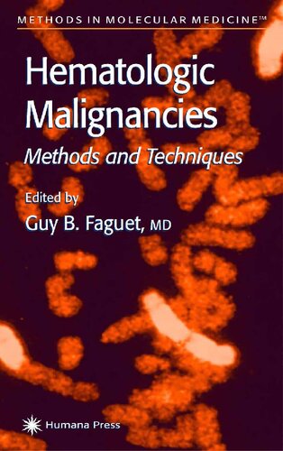 Hematologic Malignancies: Methods and Techniques (Methods in Molecular Medicine, 55)