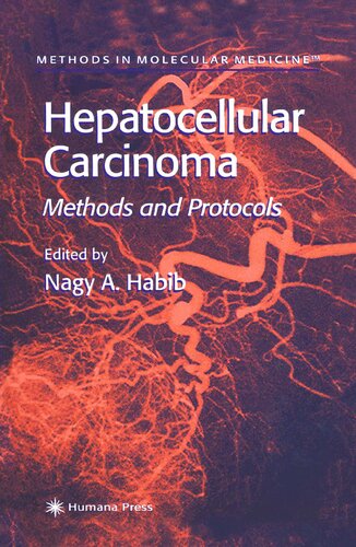 Hepatocellular Carcinoma: Methods and Protocols (Methods in Molecular Medicine, 45)