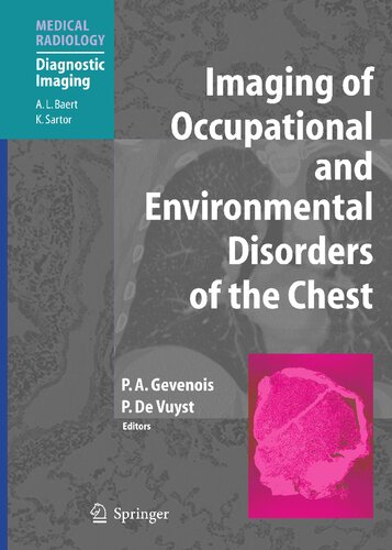 Imaging of Occupational and Environmental Disorders of the Chest (Medical Radiology)