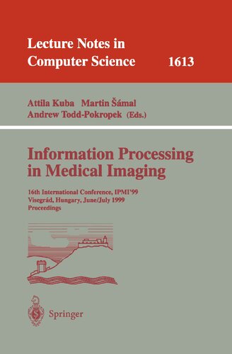 Information Processing in Medical Imaging: 16th International Conference, IPMI'99, Visegrad, Hungary, June 28 - July 2, 1999, Proceedings (Lecture Notes in Computer Science, 1613)