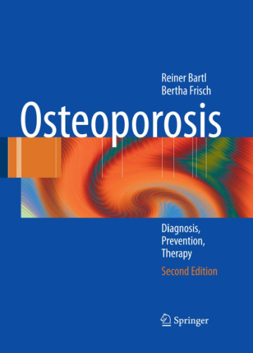 Osteoporosis: Diagnosis, Prevention, Therapy, 2nd Edition