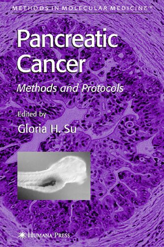 Pancreatic Cancer: Methods and Protocols (Methods in Molecular Medicine, 103)