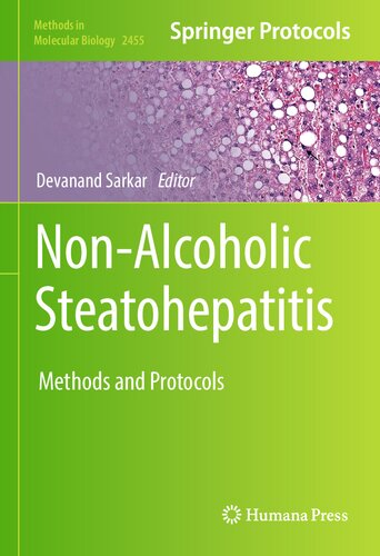 Non-Alcoholic Steatohepatitis: Methods and Protocols (Methods in Molecular Biology, 2455)