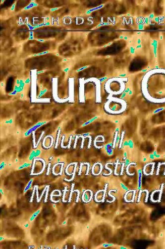 Lung Cancer: Volume 2: Diagnostic and Therapeutic Methods and Reviews (Methods in Molecular Medicine, 75)