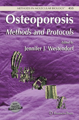 Osteoporosis: Methods and Protocols (Methods in Molecular Biology, 455)