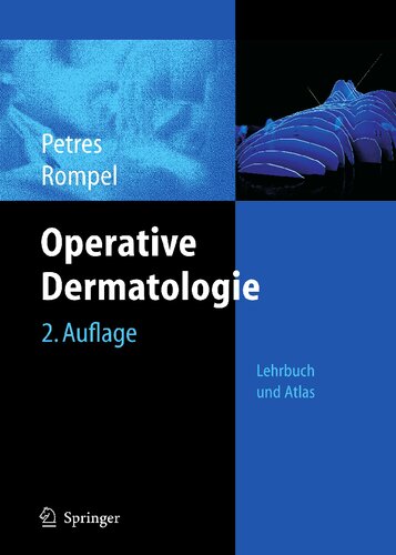 Operative Dermatologie: Lehrbuch und Atlas (German Edition)