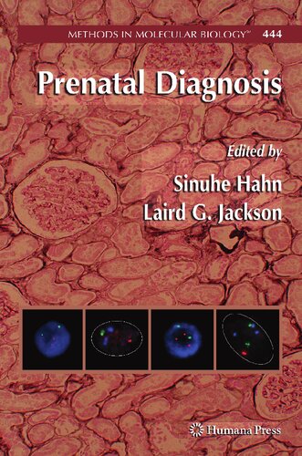 Prenatal Diagnosis (Methods in Molecular Biology, 444)