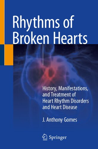 Rhythms of Broken Hearts: History, Manifestations, and Treatment of Heart Rhythm Disorders and Heart Disease