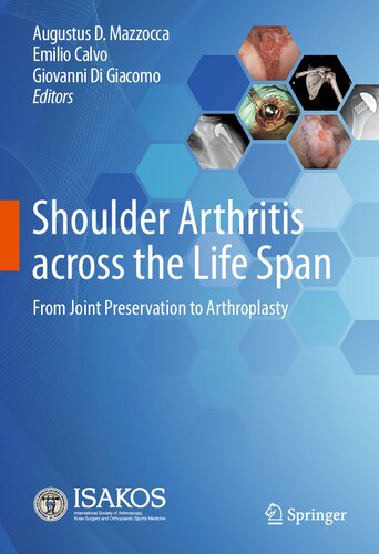 Shoulder Arthritis across the Life Span: From Joint Preservation to Arthroplasty