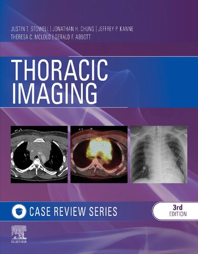 Thoracic Imaging: Case Review 3rd Edition