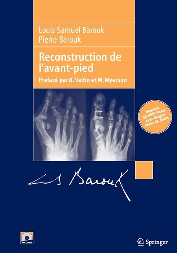 Reconstruction de l'avant-pied
