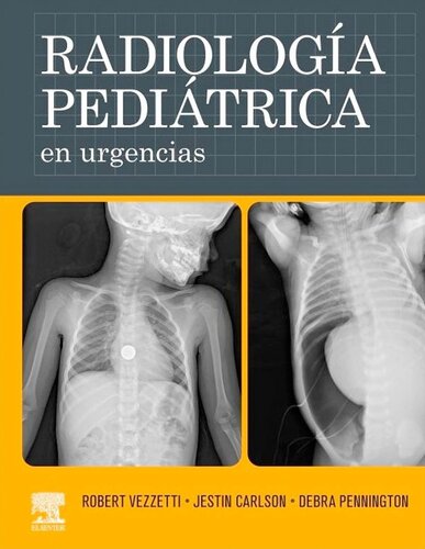 Radiologia Pediatrica En Urgencias