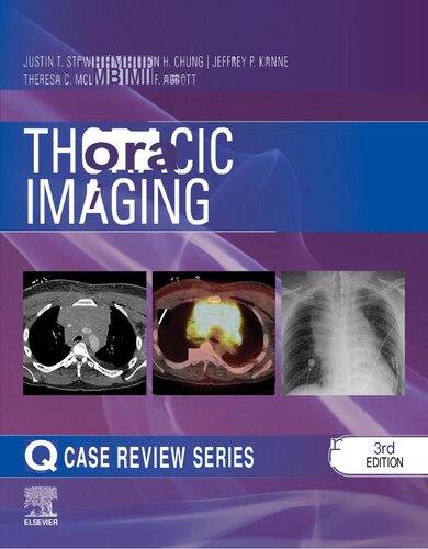 Thoracic Imaging: Case Review Series