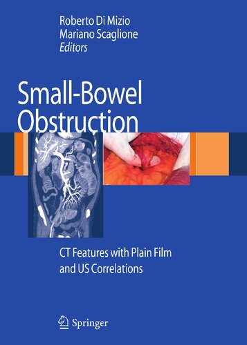Small-Bowel Obstruction: CT Features with Plain Film and US correlations