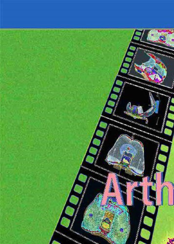 Total Knee Arthroplasty: A Guide to Get Better Performance