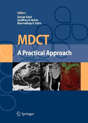 MDCT: A Practical Approach