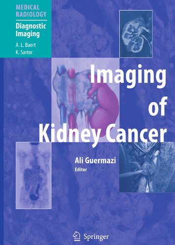 Imaging of Kidney Cancer (Medical Radiology)