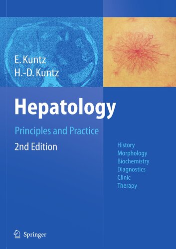 Hepatology, Principles and Practice: History, Morphology, Biochemistry, Diagnostics, Clinic, Therapy