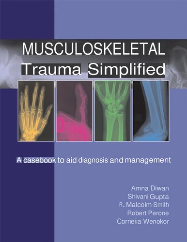 Musculoskeletal Trauma Simplified