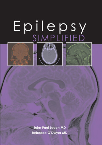Epilepsy Simplified (Simplified (TFM Publishing)) (Jan 1, 2011)_(1903378737)_(TFM Publishing)