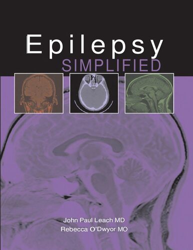 Epilepsy Simplified (Simplified (TFM Publishing)) (Jan 1, 2011)_(1903378737)_(TFM Publishing)