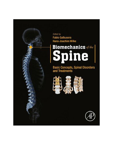 Biomechanics of the Spine
