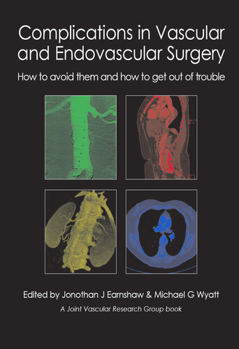 Complications in Vascular and Endovascular Surgery - How to Avoid Them and How to Get Out of Trouble (Dec 1, 2012)_(190337880X)_(TFM Publishing Ltd)