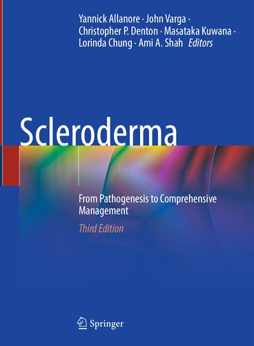Scleroderma - From Pathogenesis to Comprehensive Management, 3e (Apr 24, 2024)_(3031406575)_(Springer).pdf