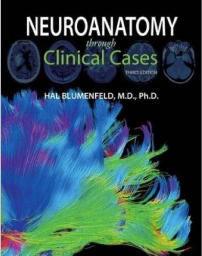 Neuroanatomy through Clinical Cases
